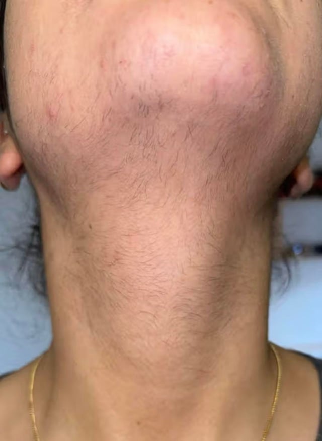 ガーリー向けの IPL を確認してください