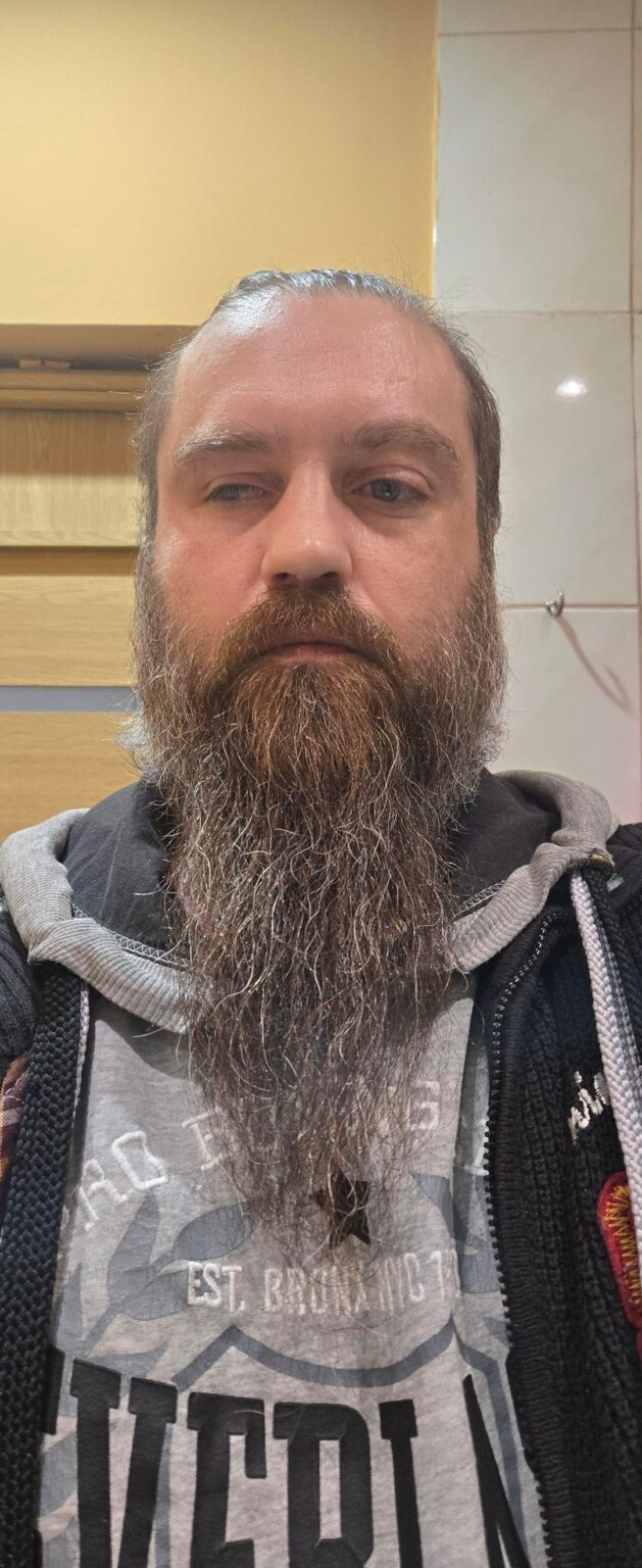 こんにちは、私はしばらくひげを生やしています。明日はダームローラーとミノキシジルの実験を始める予定です（ハゲも防ぐつもりです）。このトピックに関するリトアニア語のコンテンツがまったくないことに気付きました。進捗状況やレビューを知りたい人はいますか? それとも誰でも同じですか?