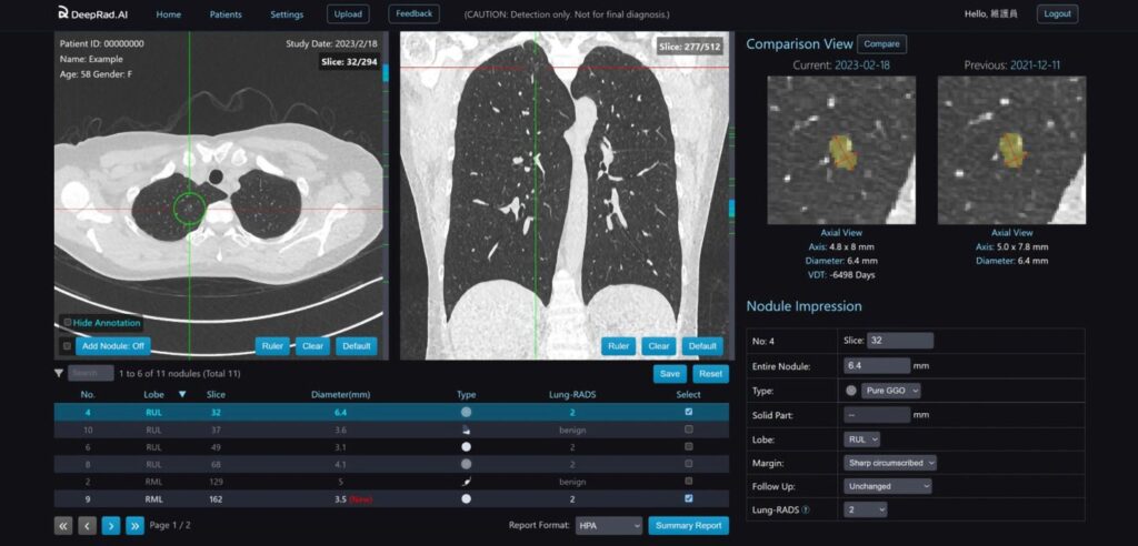 【米国 SelectUSAで世界第3位】台湾発の医療AIスタートアップDeepRad.AI、「SusHi Tech Tokyo 2026」に初出展