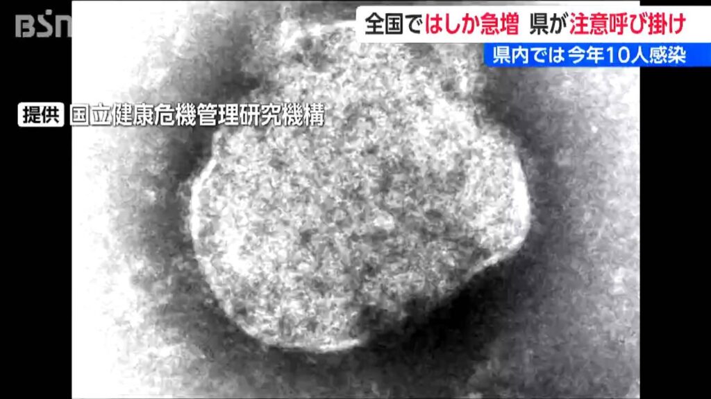 全国の『はしか』感染者数 1週間で1.4倍に急増　新潟県も注意呼びかけ（ＢＳＮ新潟放送） - Yahoo!ニュース
