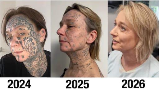 ジョークのパートナーはジョークの名前を体に250回タトゥーした：「毎日痛い」