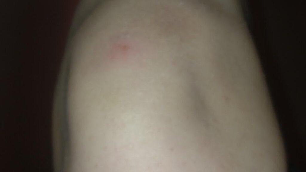 ルームメイトが私に対して攻撃的ですが、警察は助けてくれますか?