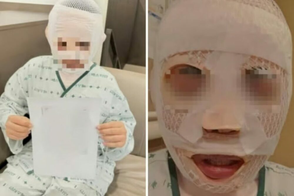 韓国・妻に熱湯を浴びせた夫、検察が懲役3年を求刑 写真枚 国際ニュース:AFPBB News 韓国・妻に熱湯を浴びせた夫、検察が懲役3年を求刑 写真枚 国際ニュース:AFPBB News