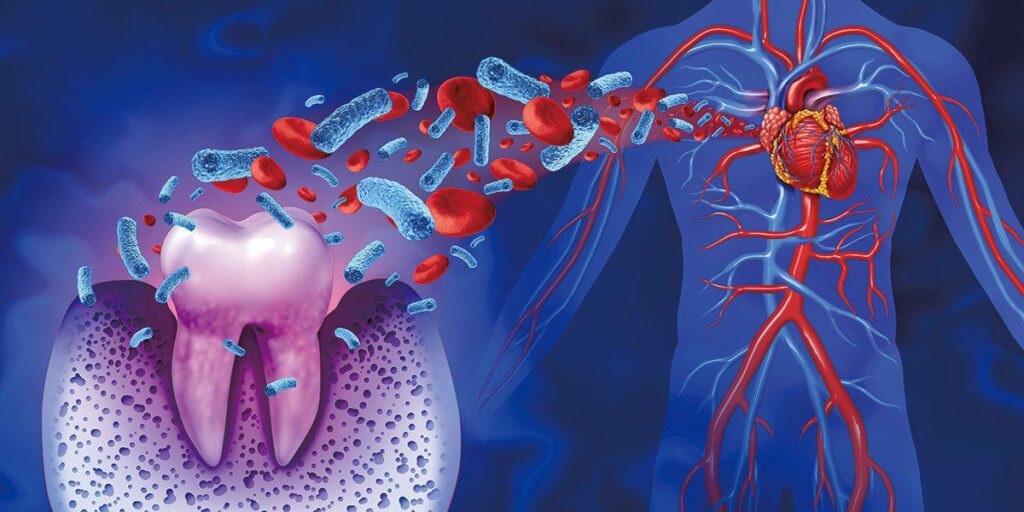 歯周病はなぜ危険なのか──心臓、脳、腎臓まで蝕む「慢性炎症」の連鎖