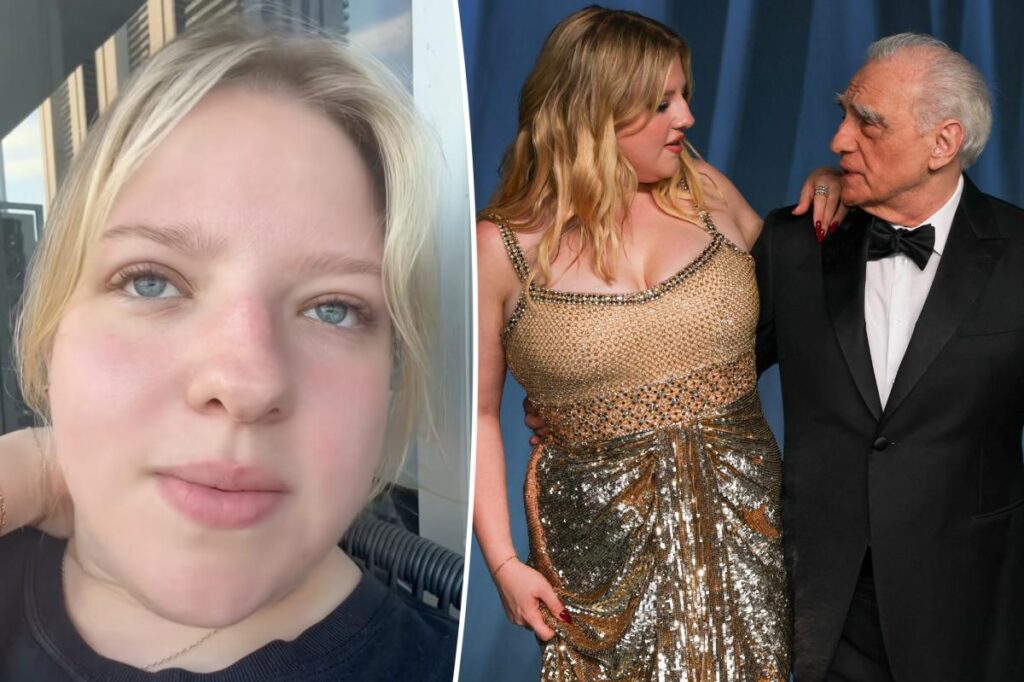 マーティン・スコセッシ監督の娘フランチェスカさん（26）、テレビで新たな役を獲得した後、容姿を切り裂く残忍な荒らし行為に反撃
