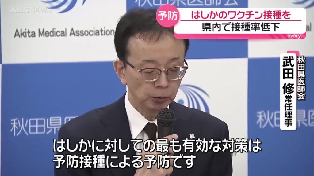 全国ではしかの患者数が増加中 過去10年間で最も多かった年とほぼ同じペース 秋田県医師会がワクチン接種を呼びかけ 秋田(2026年5月20日掲載)|ABS NEWS NNN 共有