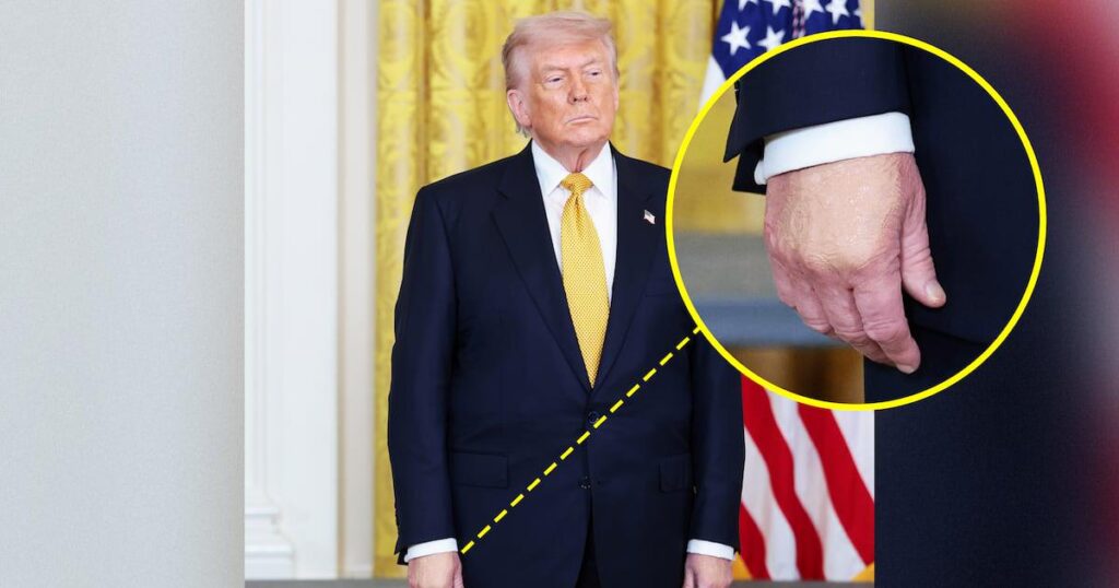 健康不安が高まる中、79歳のトランプ大統領が手の腫れを公表。大統領の両手には 2 つの異なる色合いのコンシーラーがこびりついていたが、どちらも大統領の肌の色には合わなかった。