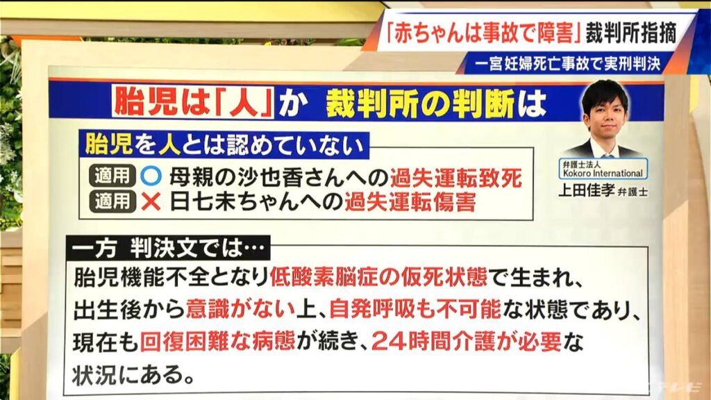 法律の世界では「人は生まれた時点で人になる」 妊婦死亡事故 障害が残った赤ちゃんの被害を裁判所はどう判断?愛知・一宮市(CBCテレビ) – Yahoo!ニュース 法律の世界では「人は生まれた時点で人になる」 妊婦死亡事故 障害が残った赤ちゃんの被害を裁判所はどう判断?愛知・一宮市(CBCテレビ) - Yahoo!ニュース