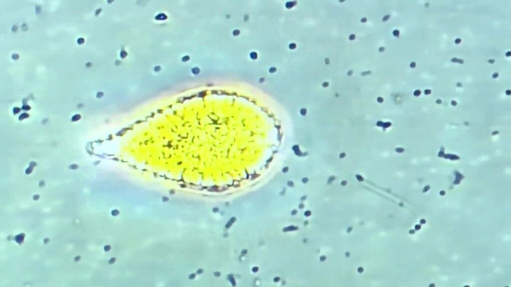 養殖カンパチ 2万100匹が死ぬ　赤潮の影響　6年連続で被害発生　熊本・天草（RKK熊本放送） - Yahoo!ニュース