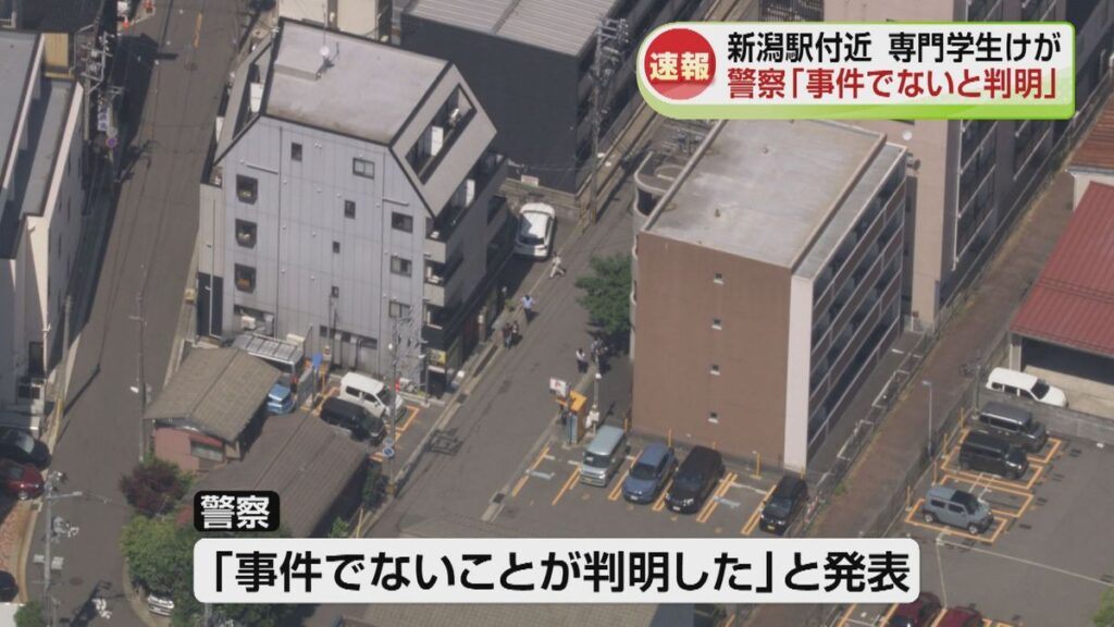 警察「事件でないと判明」と発表 新潟駅付近で専門学生がケガと通報 自分で腕を切ったか《新潟》(2026年6月12日掲載)|TeNY NEWS NNN 共有