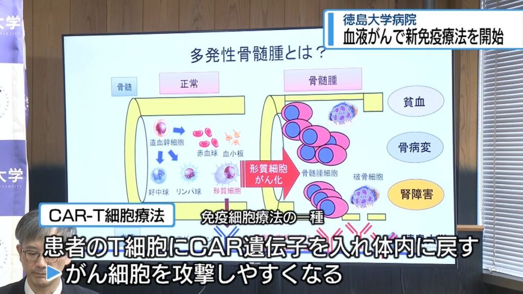 血液がんの「新しい免疫療法」開始 徳島大学【徳島】(2026年6月23日掲載)|JRT NEWS NNN 共有