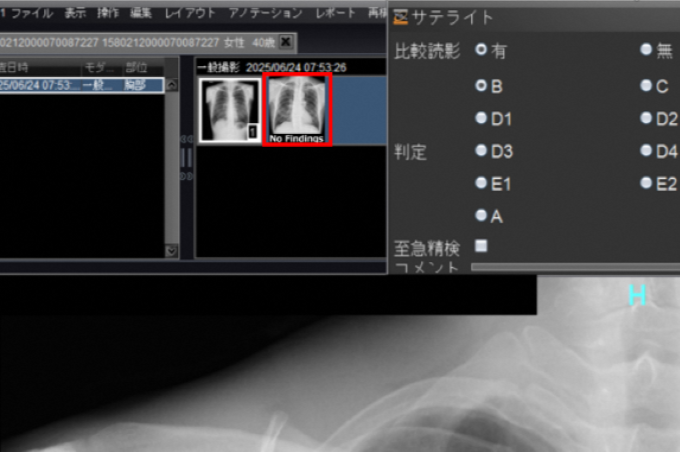 京都府内の肺がん検診にAI技術を用いた胸部X線画像診断支援プログラムを本格導入 – 株式会社Preferred Networks 京都府内の肺がん検診にAI技術を用いた胸部X線画像診断支援プログラムを本格導入 - 株式会社Preferred Networks